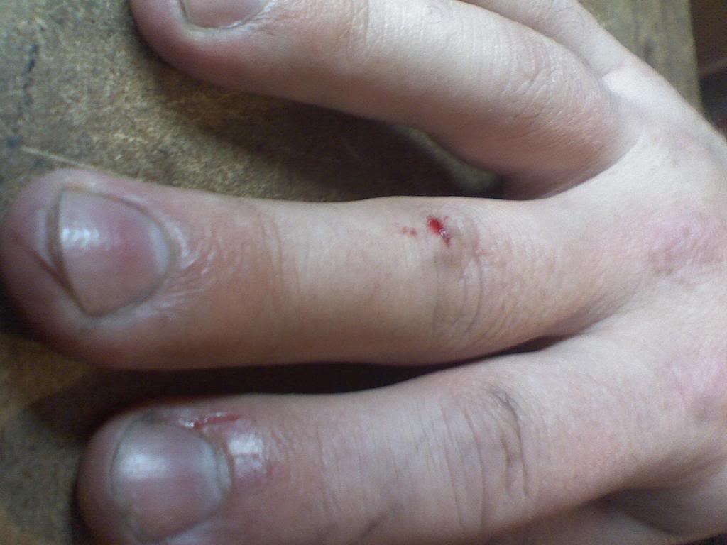 Name:  Battlewounds.jpg
Views: 56
Size:  62.8 KB